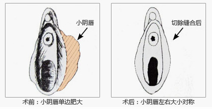 ϺҽҽԺ