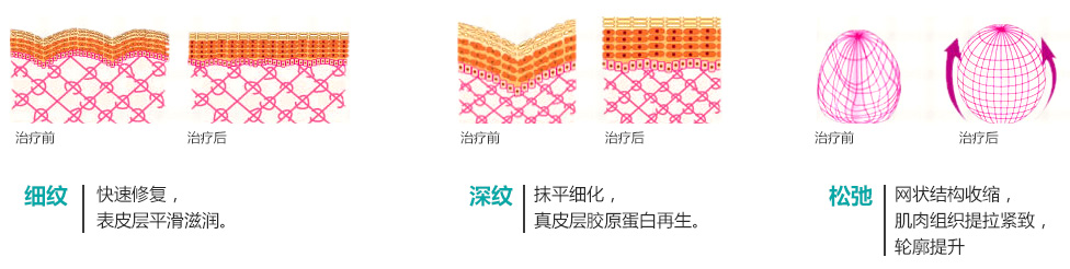 꼪Ч