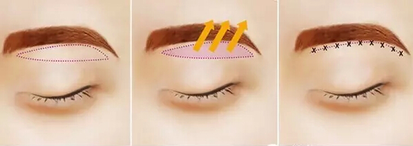 üüҽԺ