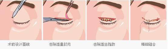 Ϻ˫ƤǮ