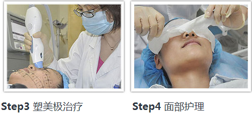 꼪