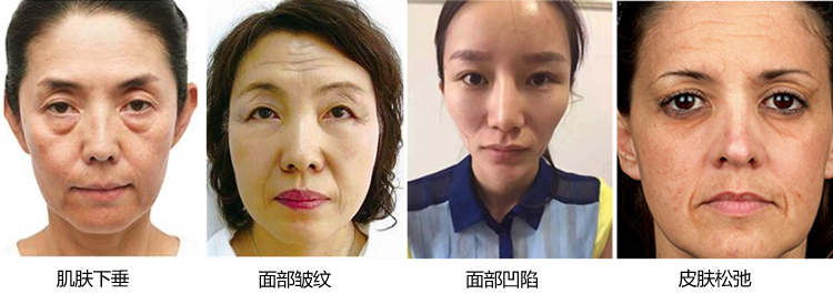 ȫ沿ۺữײ