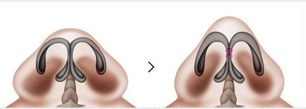 ͷαʽ