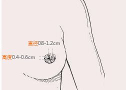 ϺҽҽԺͷݽ