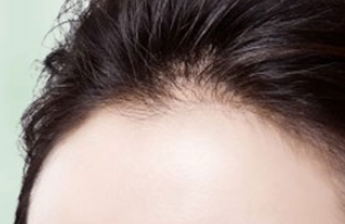 ˼ֲ