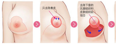 鷿´